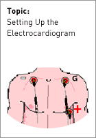 Setting up the ECG