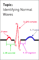 Identifying Normal Waves