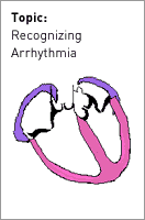 Recognizing Arrhythmia