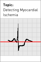 Detecting Myocardial Ischemia